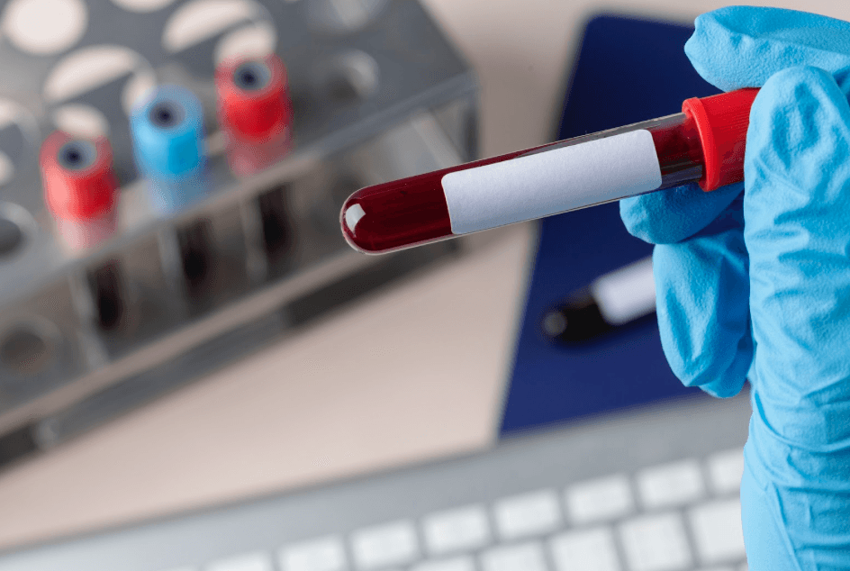 Artykuł Badania krwi, a zaburzenia żołądkowo-jelitowe